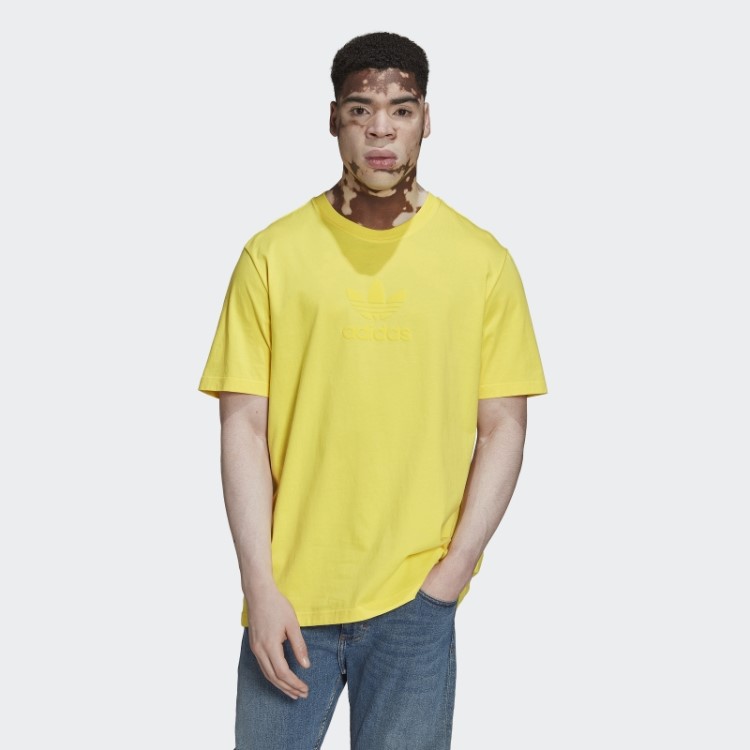 Camiseta De Rua Amarela Adidas Trefoil Series